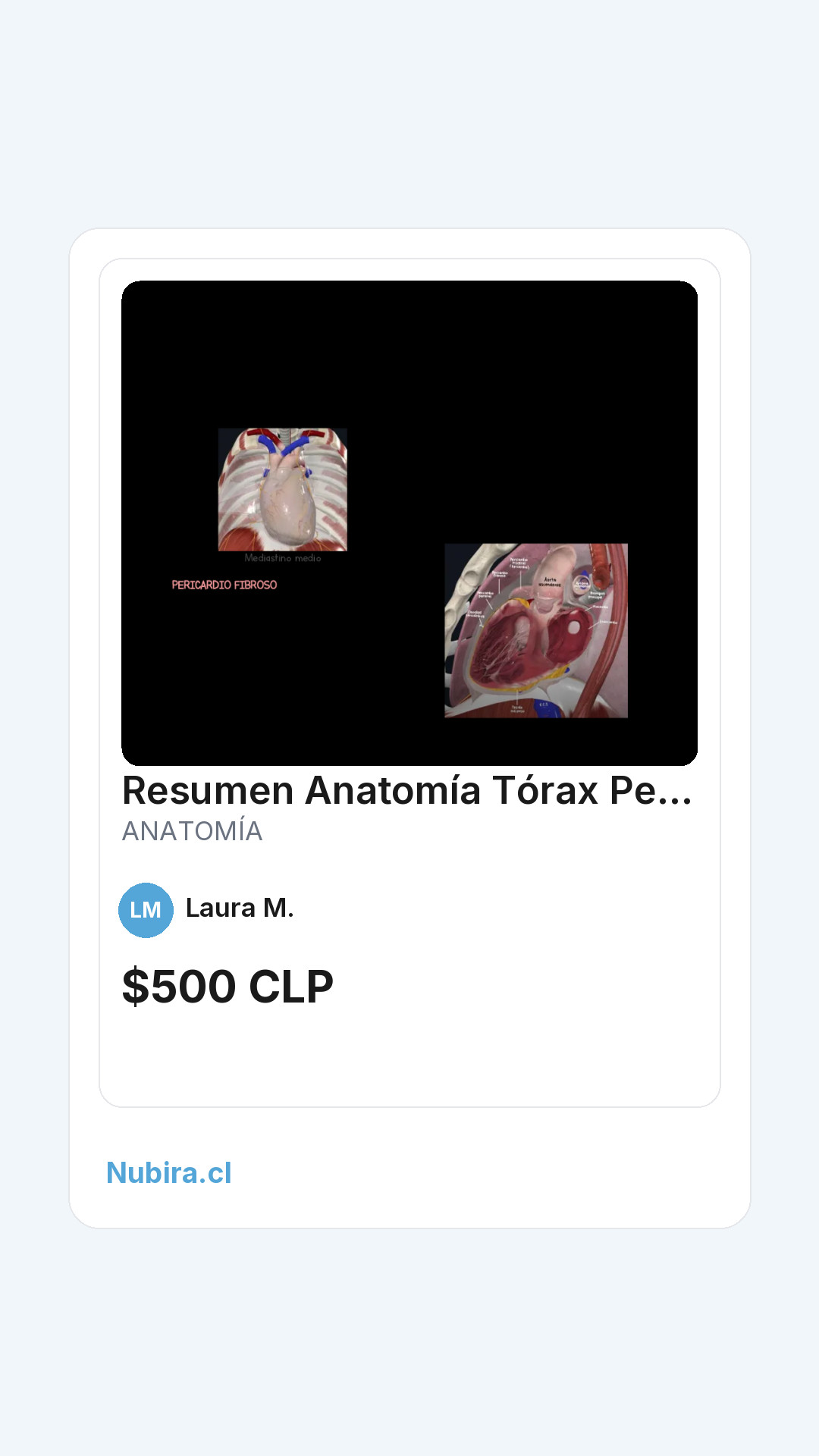 Vista previa historia